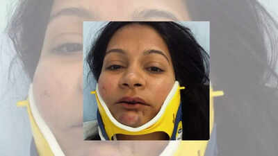 An indian couple claimed they were brutally attacked by a chinese person at a hotel in switzerland u.jpeg