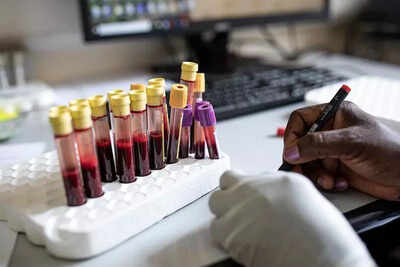 Hiv jab for 115 nations rests on indian regulators.jpg