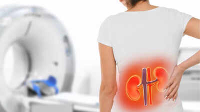 Silent killer woman shares common signs of kidney failure she ignored.jpg