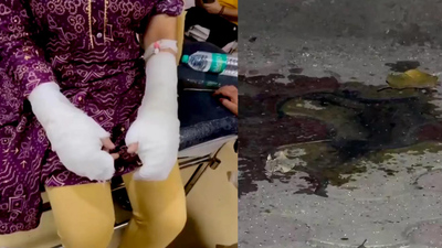 Du student 19 attacked with acid by stalker aides.jpg