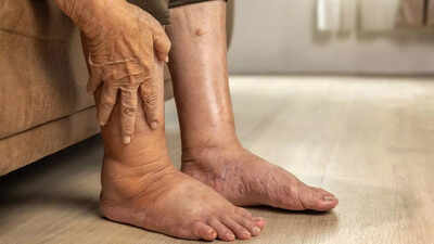 Pancreatic cancer 4 warning signs in your legs that you shouldn39t ignore.jpg