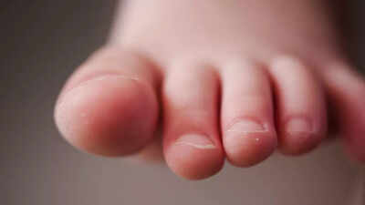 Early warning signs of vitamin b12 deficiency can appear in your toes.jpg