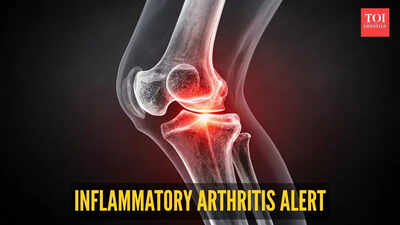 Inflammatory arthritis alert.jpg