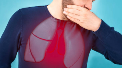 Lung cancer isnt just a smokers disease say oncologists and warn on early signs this awareness month.png