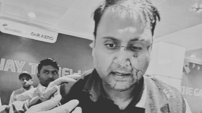 Passenger beaten by off duty air india express pilot suffers nasal fracture.jpg