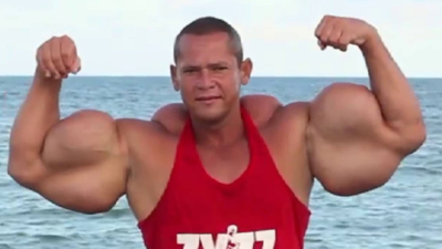 Brazilian popeye bodybuilder arlindo de souza dies at 55 after kidney failure linked to oil injectio.png
