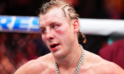 Im all good hospitalized paddy pimblett breaks silence as wife reveals brutal ufc 324 aftermath phot.png
